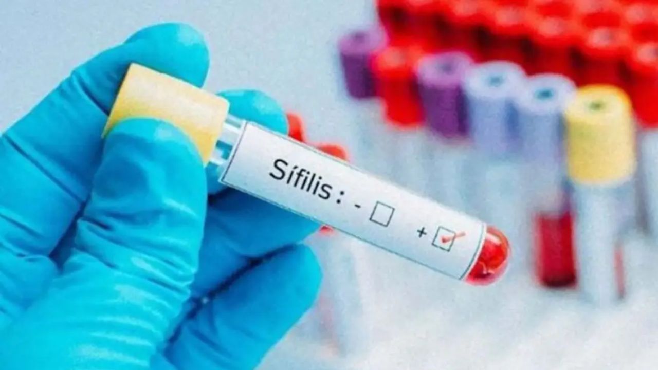 Alertan sobre transmisión congénita de sífilis en México