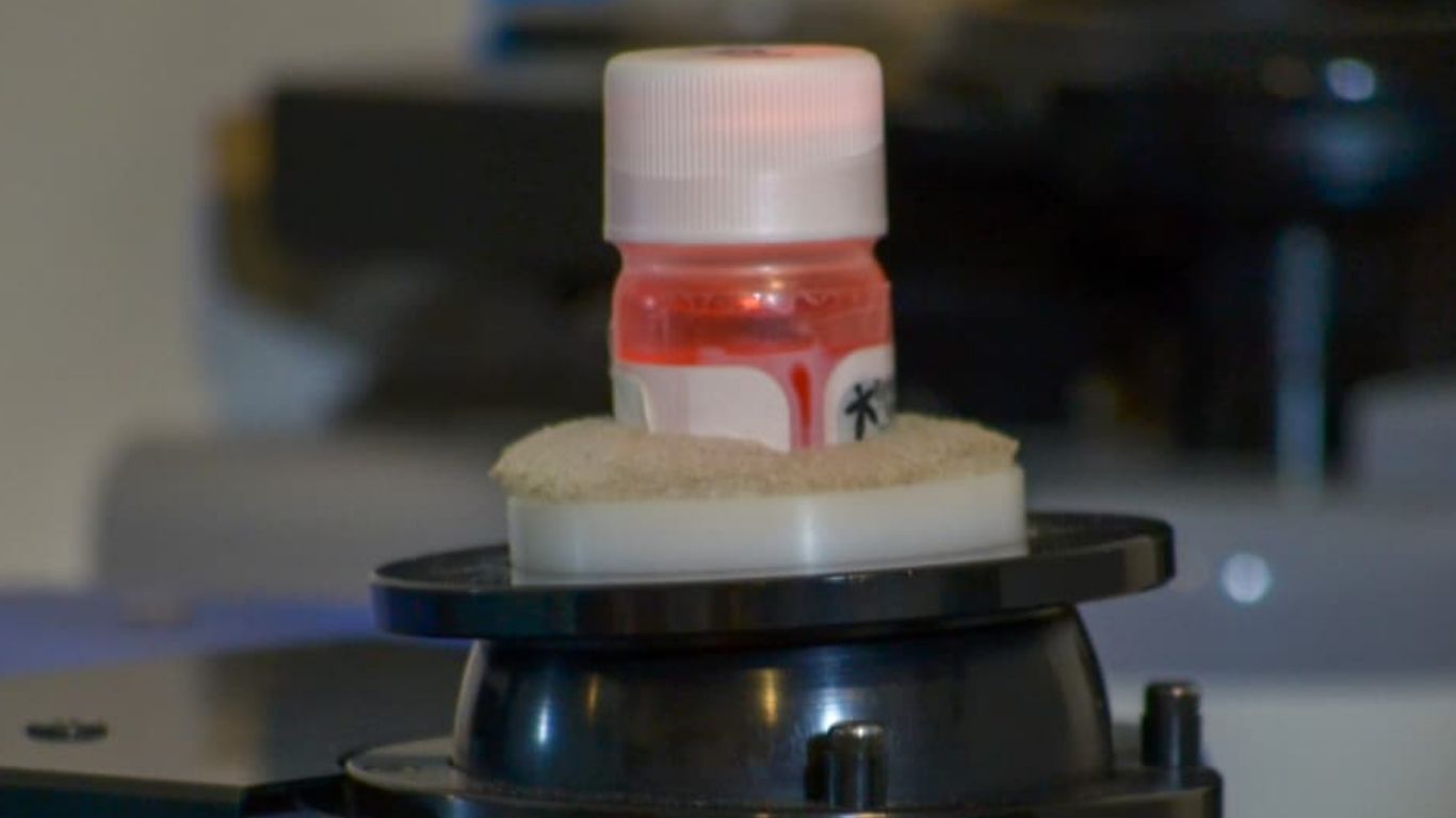 Donación de tejido óseo permitirá salvar extremidades