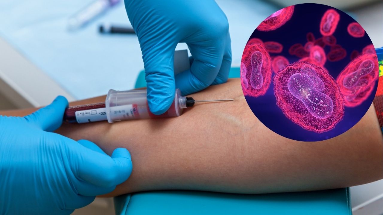 Vigilancia epidemiológica y diagnóstico por laboratorio de mpox