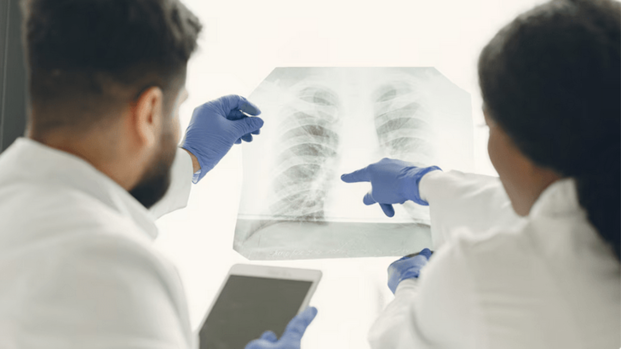 Virus Metapneumovirus humano no representa ningún riesgo para México