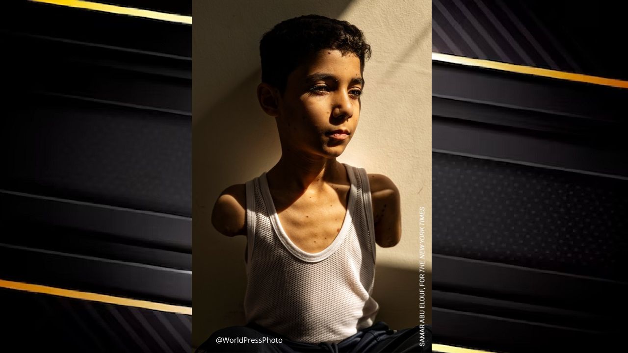Imagen de un niño gazatí gana premio de Foto del Año del World Press Photo
