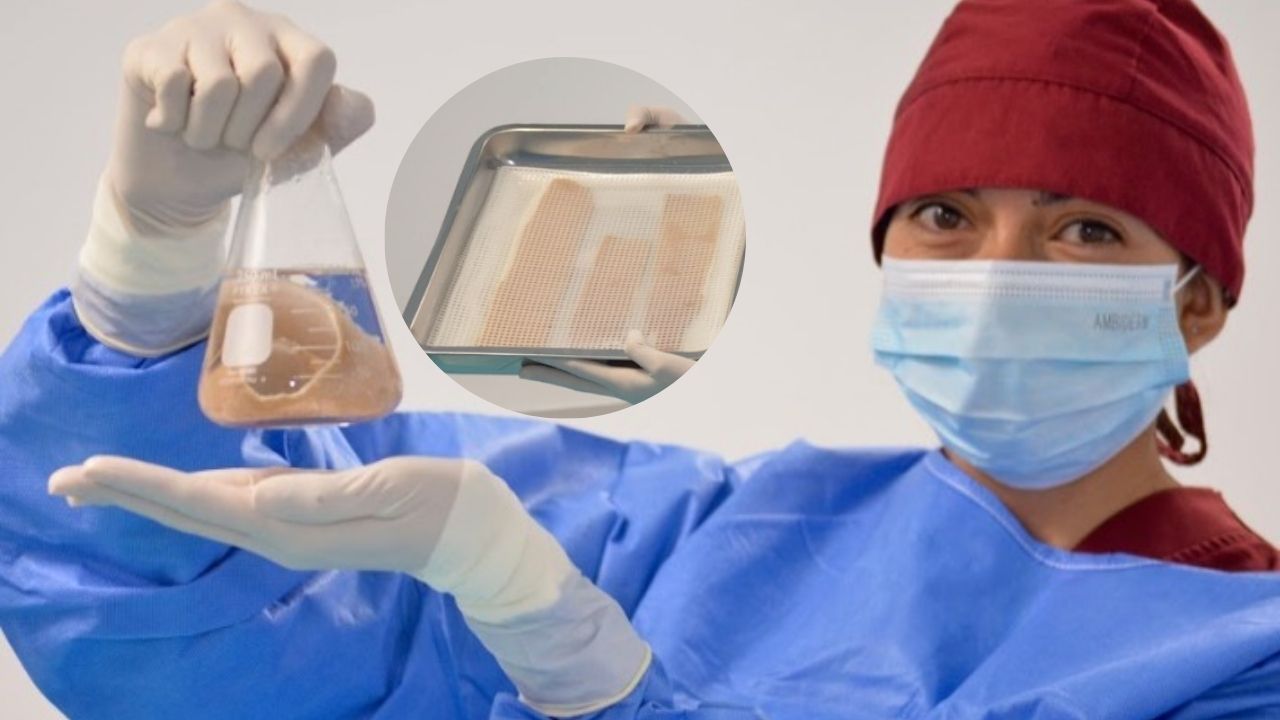 Edomex dona tejido amniótico para víctimas de explosión en Iztapalapa 