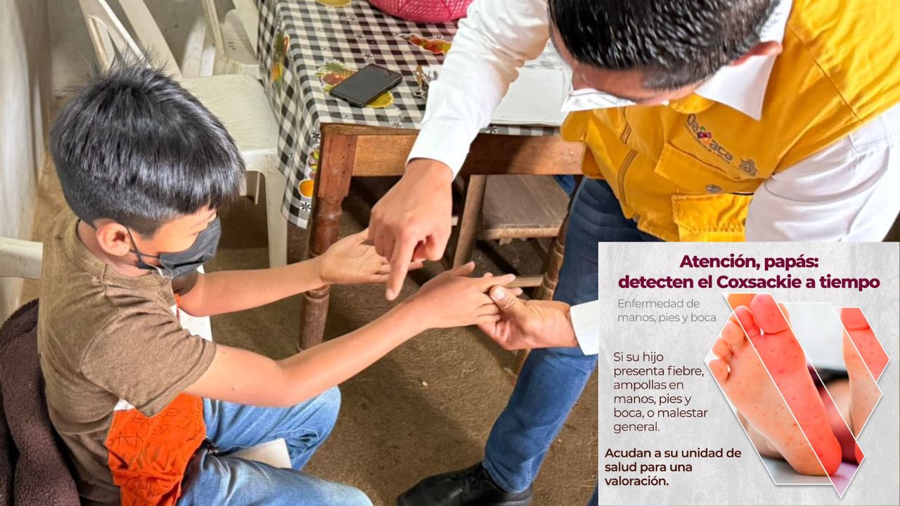 ¡Alerta en Oaxaca! Suman 753 casos de virus Coxsackie en menores