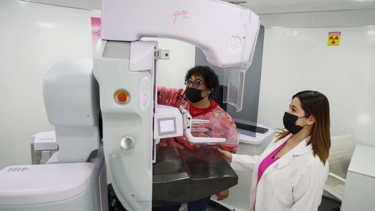 En marcha los primeros 20 mastógrafos móviles