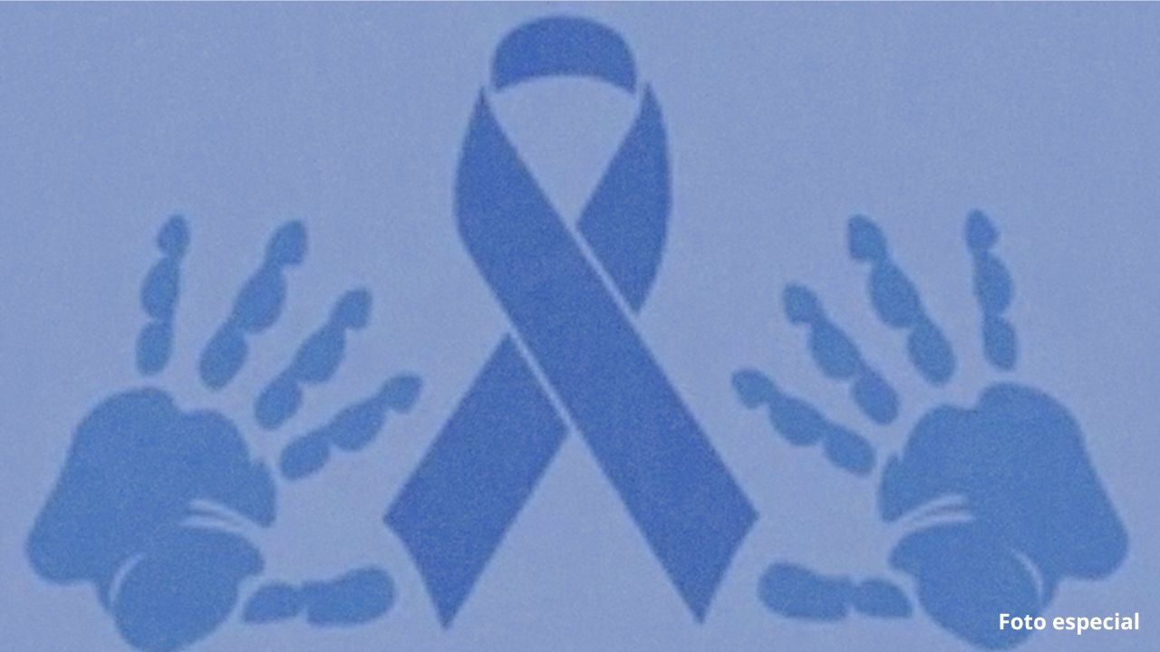 Día Internacional del Síndrome de Treacher Collins; urgen a la detección temprana