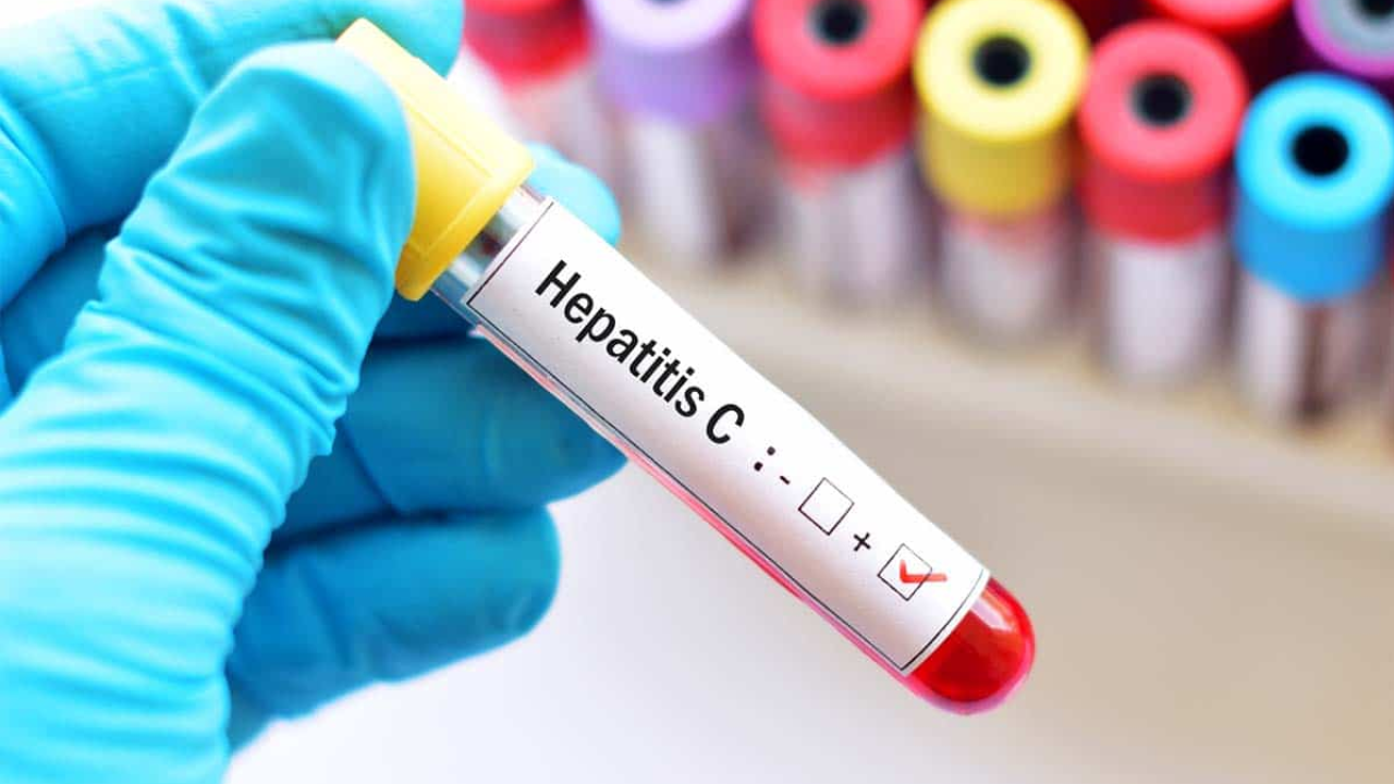 México busca erradicar la hepatitis C para 2030